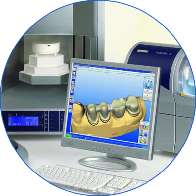 3D牙齒打印技術